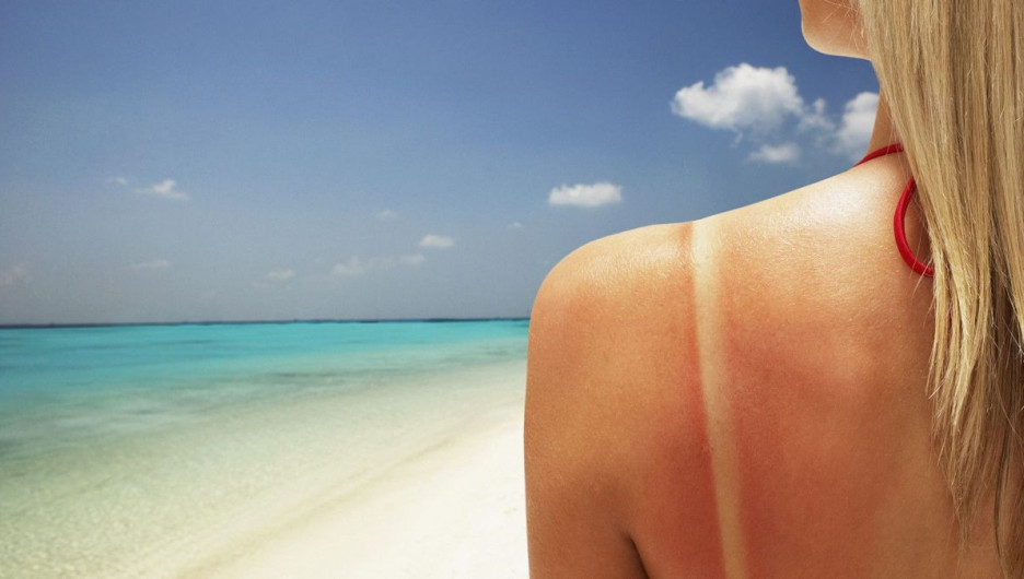 Мифы и правда о солнечных ваннах. Так ли полезен загар?