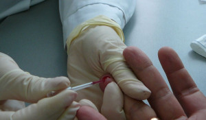 Экспресс-тестирование на ВИЧ-инфекцию.