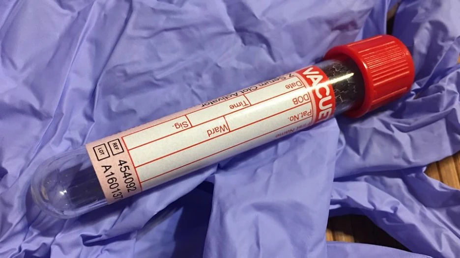 Медицина. Здоровье. Кровь.