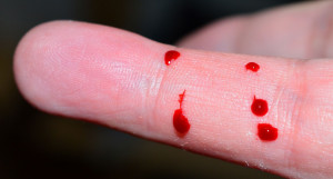 Кровь на пальце.