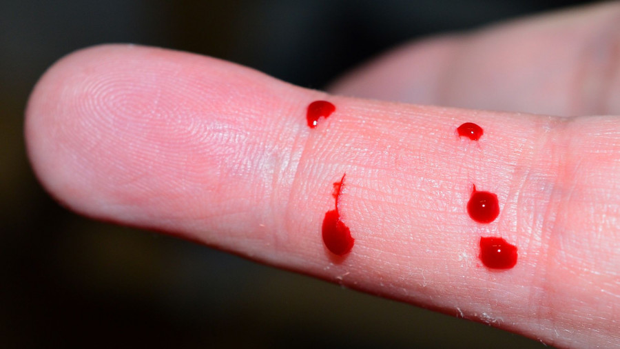 Кровь на пальце.