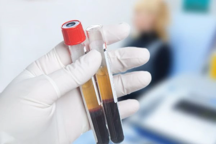 Плазмотерапия.