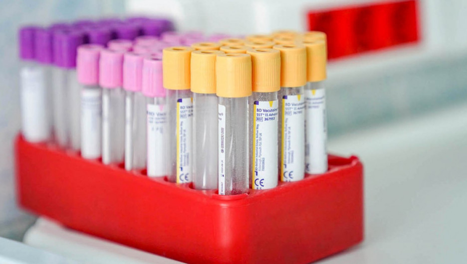 Сколько стоят домашние экспресс-тесты на коронавирус и можно ли им доверять?