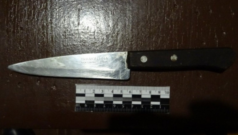 Новосибирец убил друга, пытаясь вырезать ему ножом варикоз