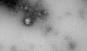 Британский штамм.