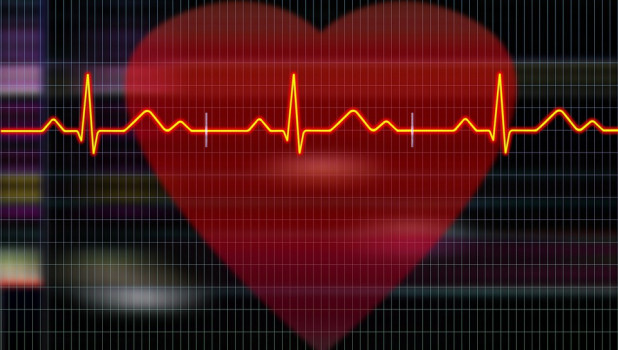 Сердце, кардиограмма.