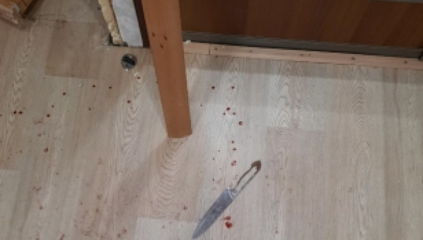 Пьяный россиянин напал на полицейского с ножом, и тот выстрелил ему в живот