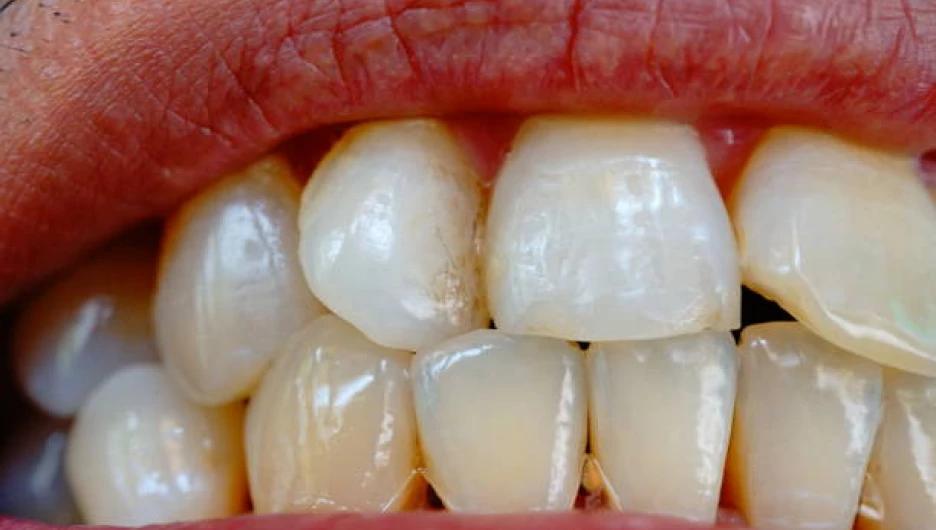 Неочевидные секреты правильного ухода за зубами раскрыли врачи