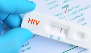 Экспресс-тест на ВИЧ.