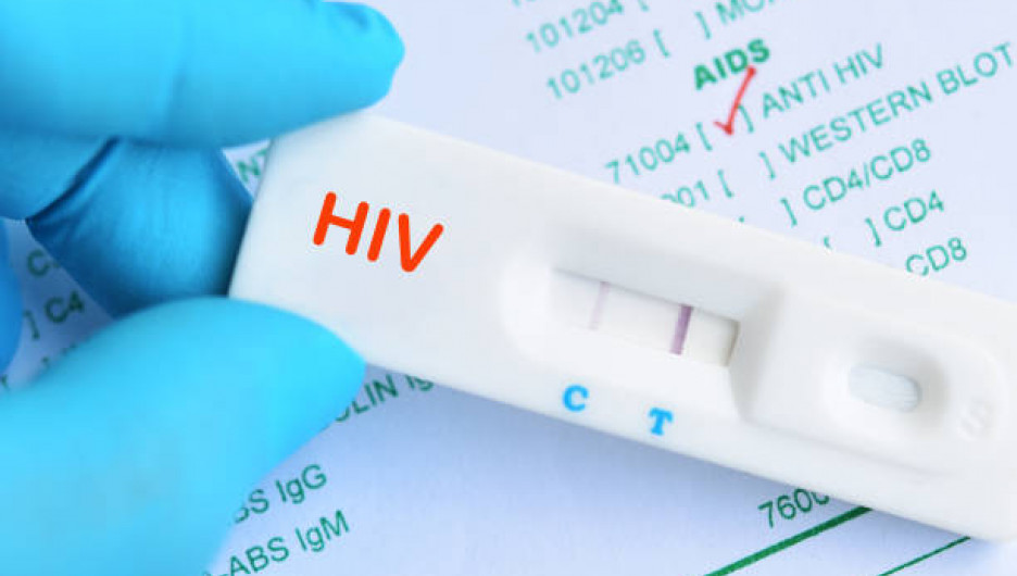 Экспресс-тест на ВИЧ.