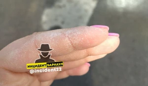 Жительница Барнаула получила ожог пальцев в пункте выдачи Ozon