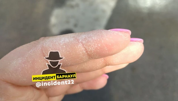 Жительница Барнаула получила ожог пальцев в пункте выдачи Ozon