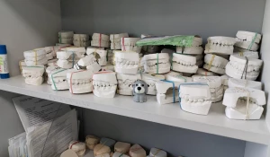 Слепок зубов