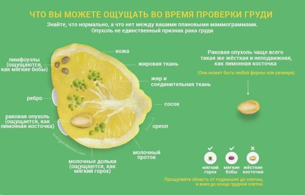 Строение молочной железы