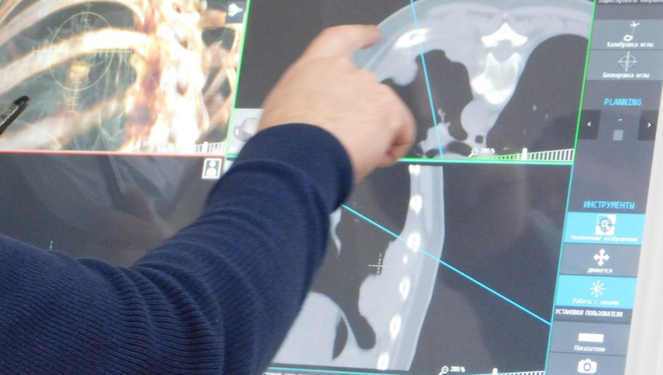Взгляд изнутри. Алтайские онкологи начали использовать VR-технологии для исследования заболеваний