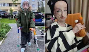 Стало известно, как живет 15-летняя девочка-Добби с прогерией