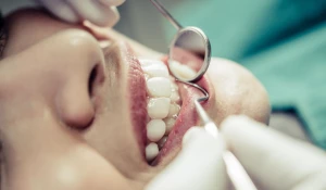 Осмотр у стоматолога.