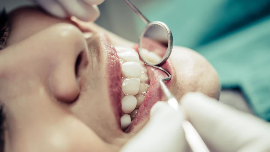 Осмотр у стоматолога.