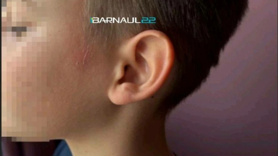 Водитель маршрутки прищемил мальчику голову дверьми.