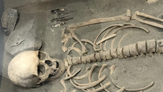 Череп, скелет, останки.