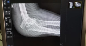 Травма. Травмпункт.