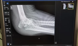 Травма. Травмпункт.