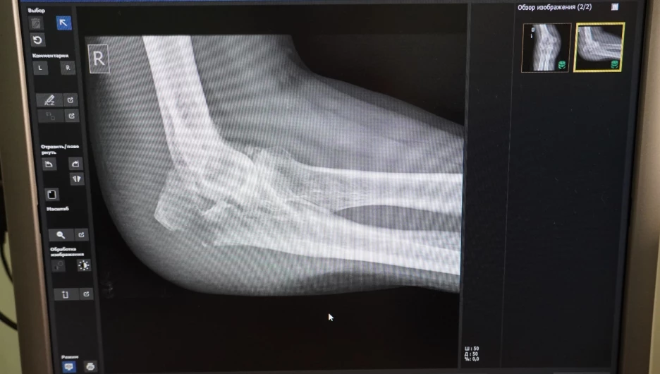 Травма. Травмпункт.