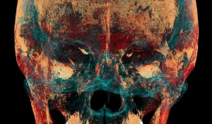 Фото черепа тела женщины возрастом 2,5 тыс. лет.